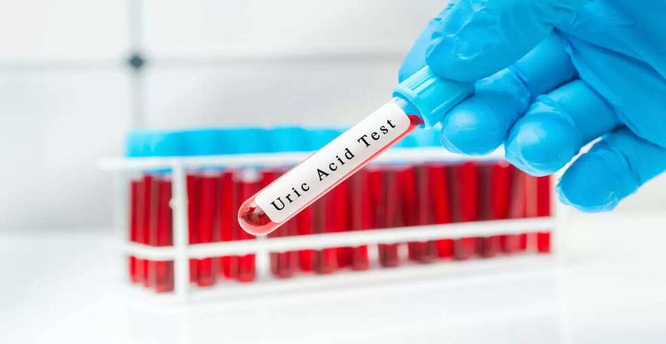 सर्दियों में यूरिक एसिड के बढ़ने के लक्षण और नियंत्रण के उपाय