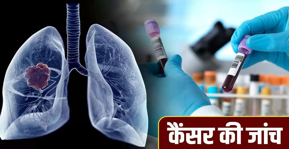 नई तकनीक से लंग कैंसर की पहचान में मिलेगी मदद: ब्लड टेस्ट से होगी जांच