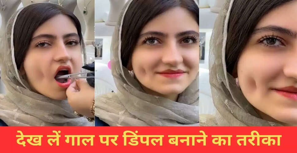 सोशल मीडिया पर डिंपल बनाने का अनोखा तरीका हुआ वायरल
