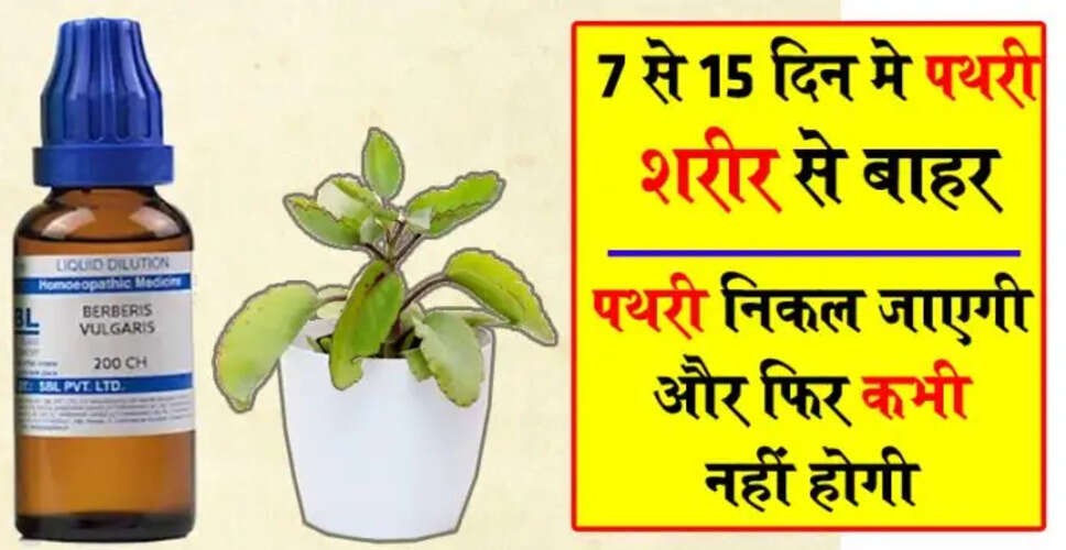 पथरी के इलाज के लिए प्राकृतिक उपाय और होमियोपेथी