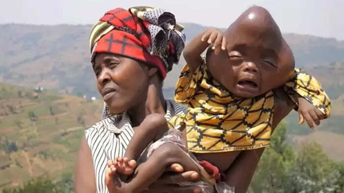 रवांडा में पिता ने नवजात बच्चे को देखकर पत्नी को छोड़ दिया