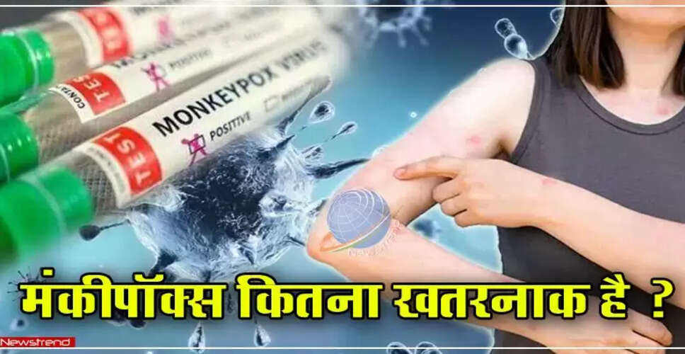 भारत में मंकीपॉक्स: लक्षण, फैलने का तरीका और खतरे