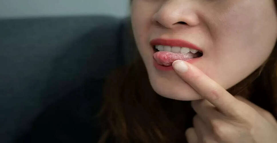 पेट की गर्मी से मुंह में छालों का इलाज: जानें विशेषज्ञ की सलाह
