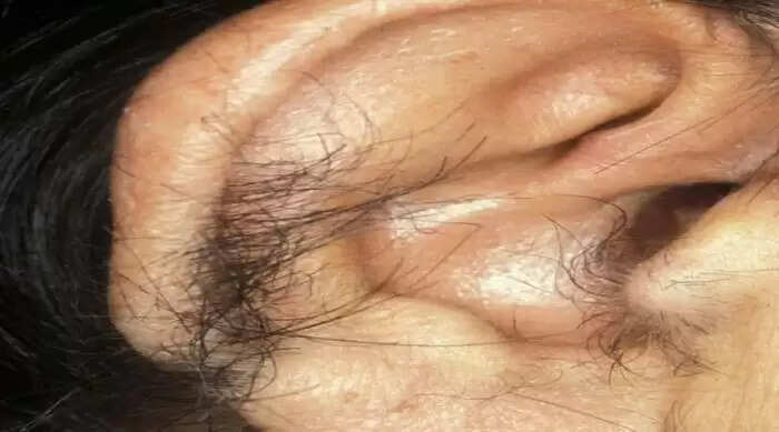 कान के बाल और जीवन के राज: जानें क्या कहते हैं ये संकेत