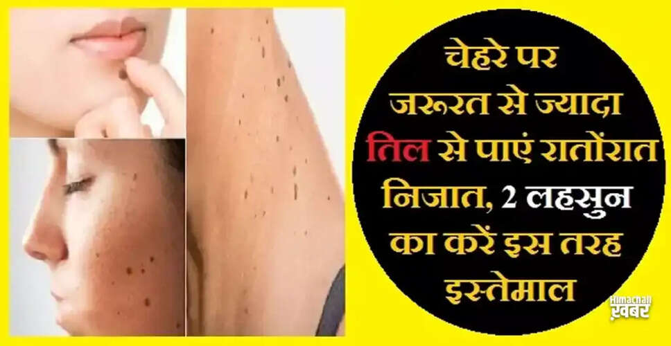 अनचाहे तिल हटाने के लिए लहसुन का उपयोग कैसे करें