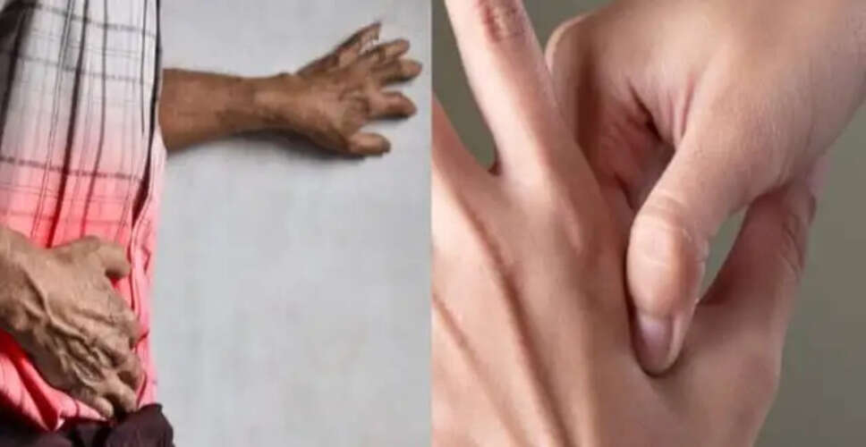 पेट में गैस से राहत पाने के लिए एक्यूप्रेशर तकनीक