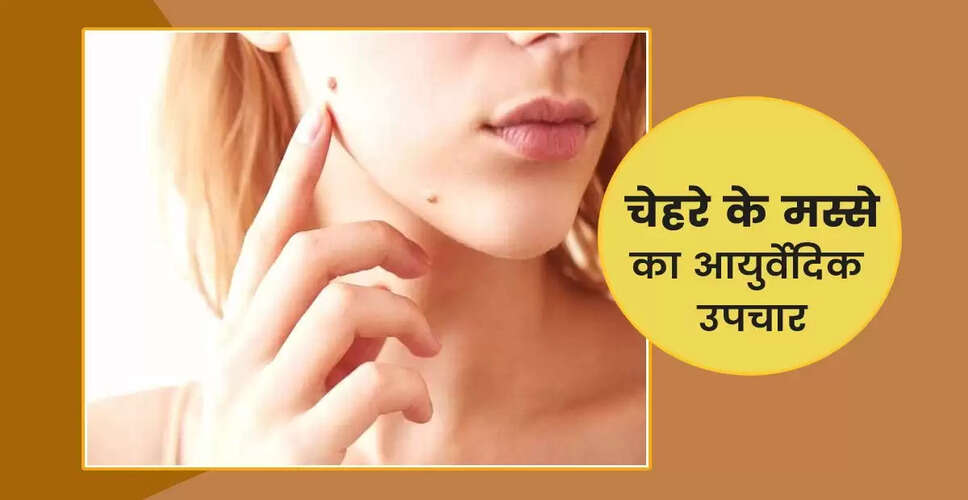 मस्सों के लिए प्रभावी आयुर्वेदिक उपचार